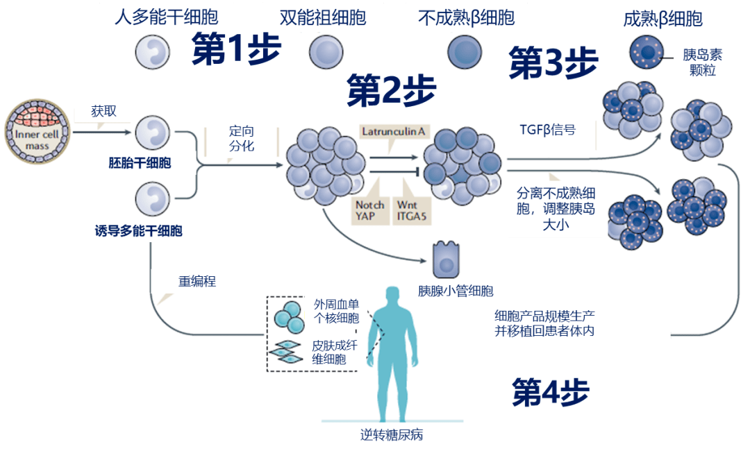 干细胞治疗糖尿病最新进展,干细胞治疗糖尿病的最新进展